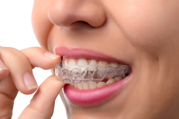 Ways To Help You Adjust To Clear Aligners