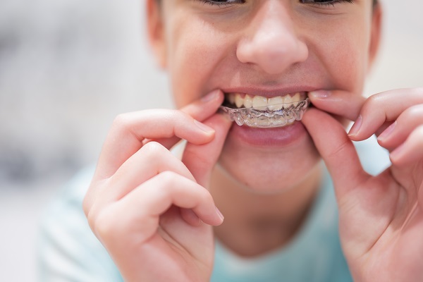 What To Ask Your General Dentist About Clear Braces For Teeth Straightening