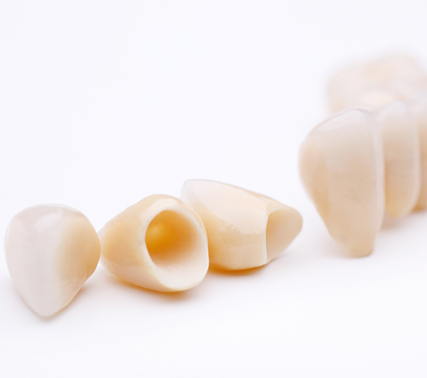 Commerce Dental Crowns and Dental Bridges