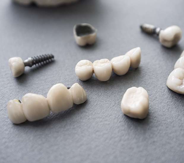 Commerce The Difference Between Dental Implants and Mini Dental Implants
