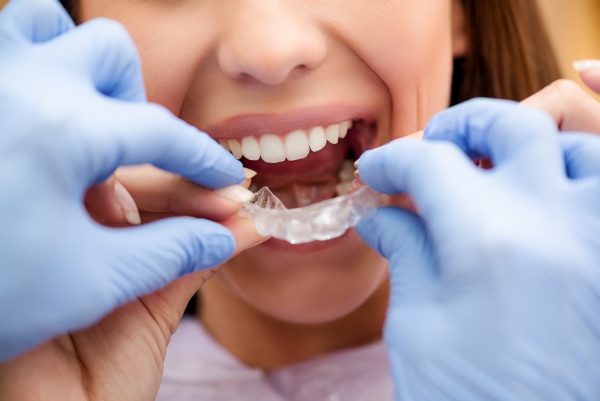 Tips For Finding An Invisalign Dentist Near Commerce