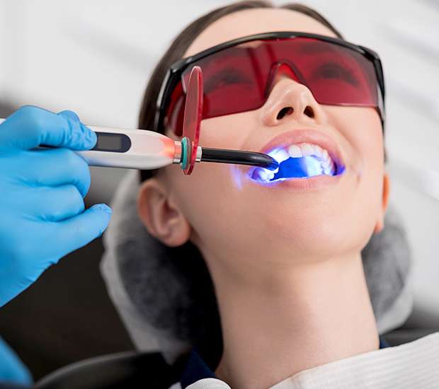Commerce Professional Teeth Whitening
