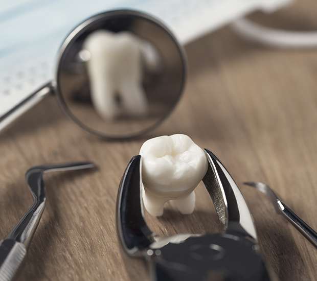 Commerce When Is a Tooth Extraction Necessary